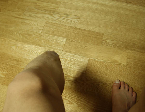파일:불구.jpg