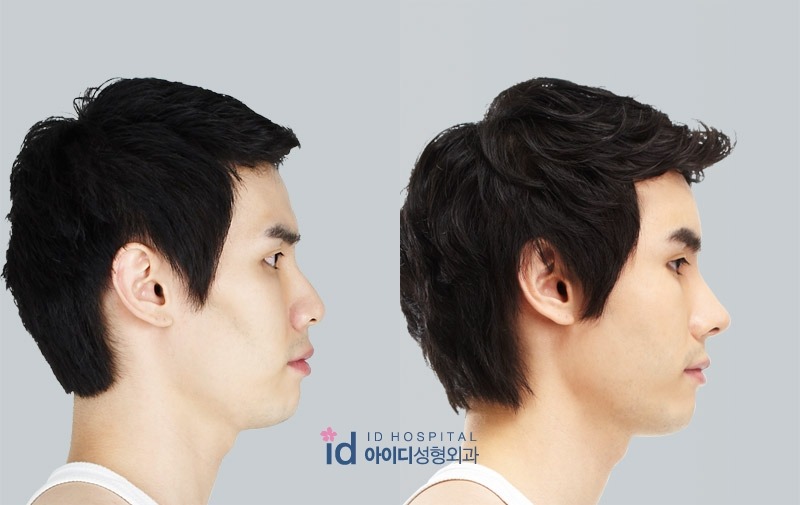 파일:콧대비교.jpg