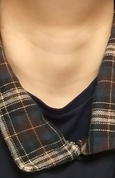 파일:목젖.jpg