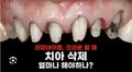 2026년 2월 25일 (수) 09:04 판의 섬네일