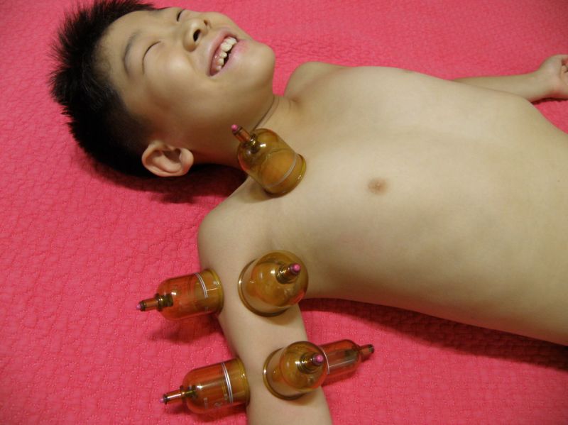파일:부항해탈.jpg