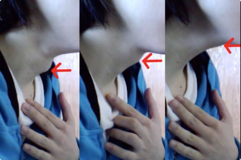 파일:목젖상태.jpg