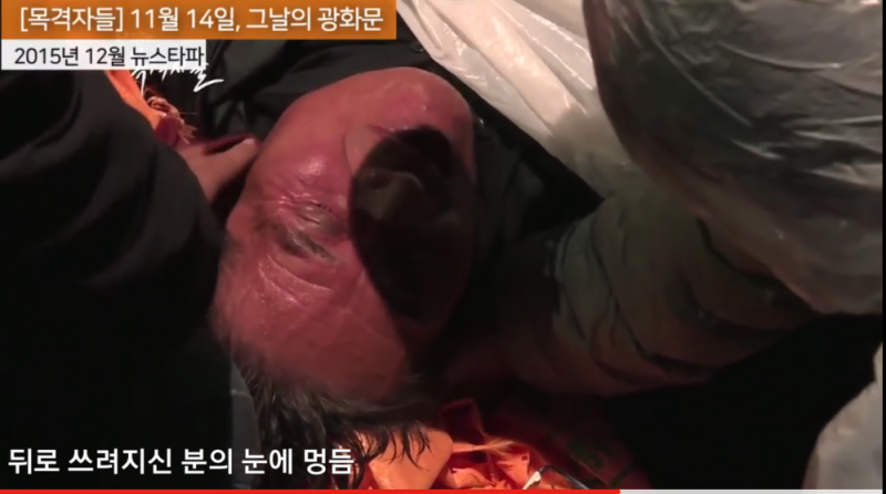 파일:백남기멍듬.png