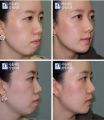 2026년 1월 5일 (월) 19:09 판의 섬네일